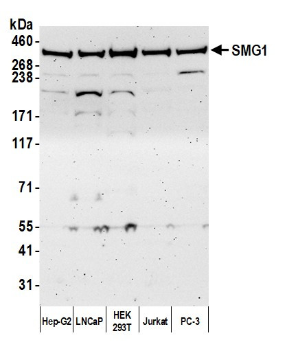 SMG1 Antibody in Western Blot (WB)