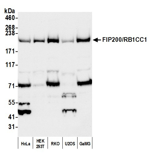 FIP200/RB1CC1 Antibody in Western Blot (WB)
