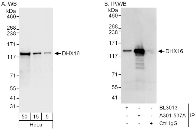 DHX16 Antibody in Western Blot (WB)