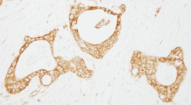 USP3 Antibody in Immunohistochemistry (Paraffin) (IHC (P))