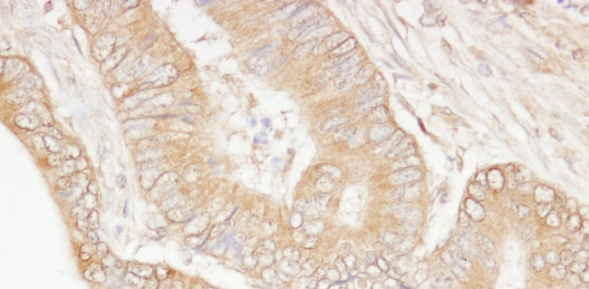 USP5/IsoT Antibody in Immunohistochemistry (Paraffin) (IHC (P))