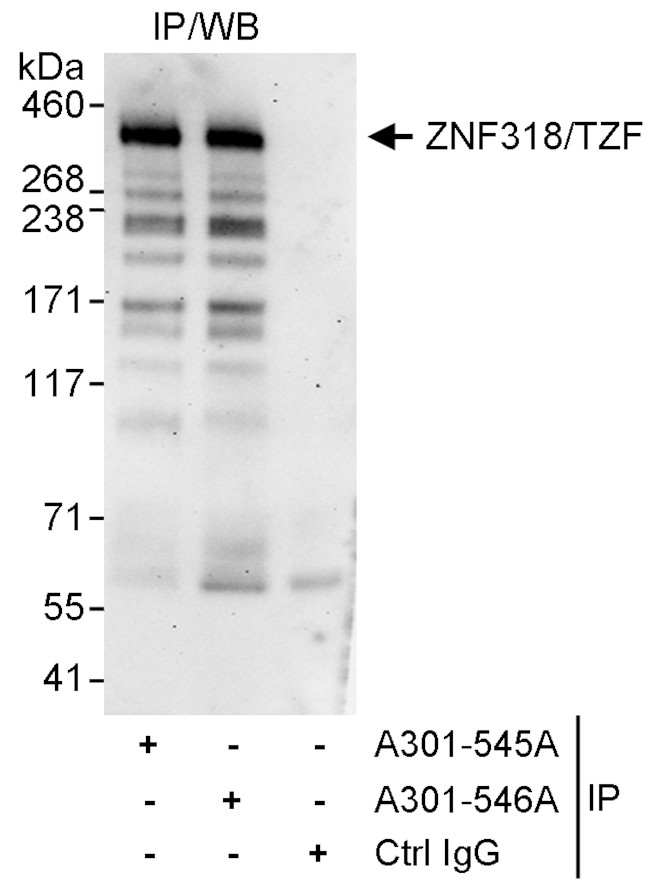 ZNF318/TZF Antibody in Immunoprecipitation (IP)