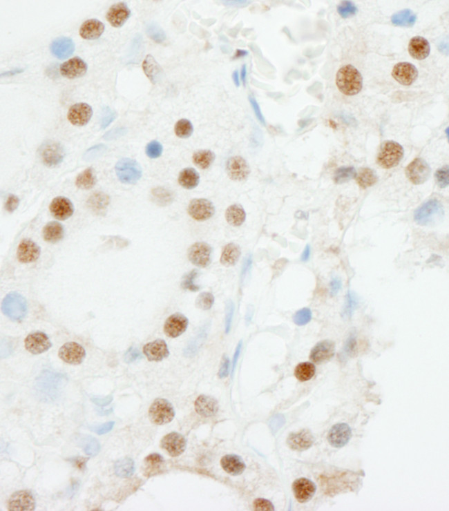 ZNF318/TZF Antibody in Immunohistochemistry (Paraffin) (IHC (P))