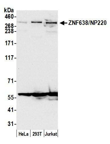 ZNF638/NP220 Antibody in Western Blot (WB)