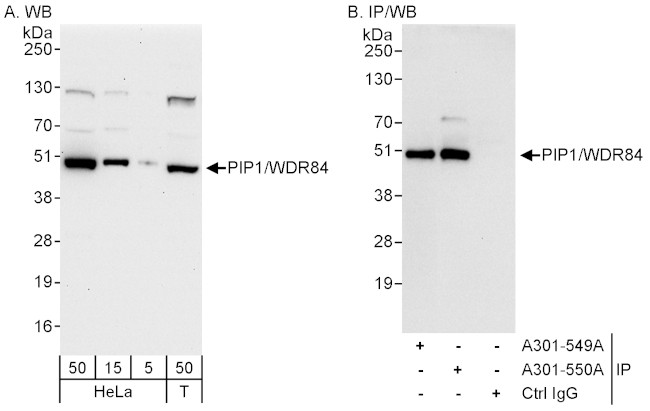 PIP1/WDR84 Antibody in Western Blot (WB)