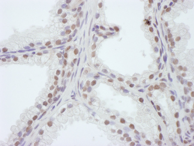 WDR4 Antibody in Immunohistochemistry (Paraffin) (IHC (P))