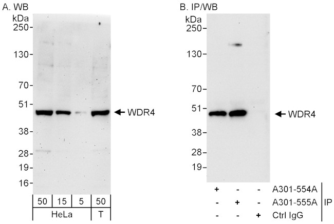 WDR4 Antibody in Western Blot (WB)