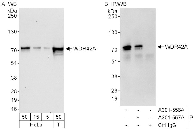 WDR42A Antibody in Western Blot (WB)