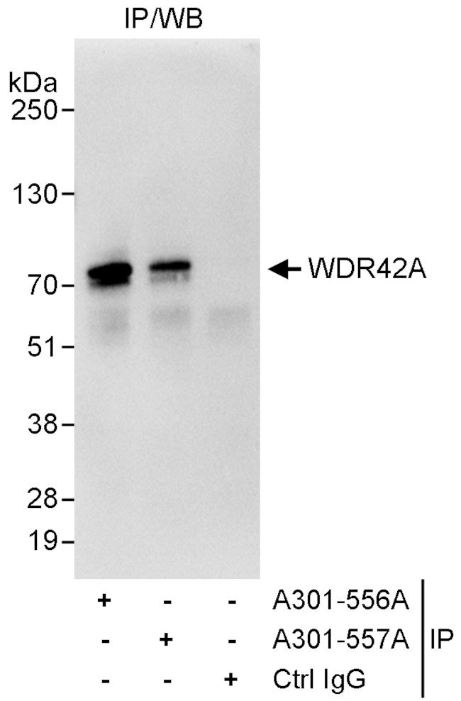 WDR42A Antibody in Immunoprecipitation (IP)