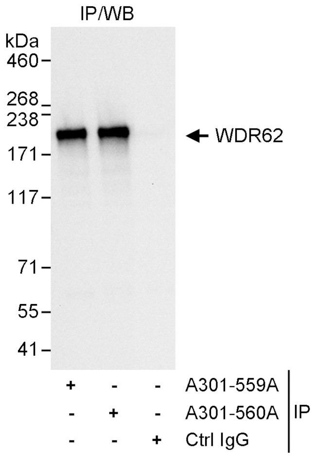 WDR62 Antibody in Immunoprecipitation (IP)