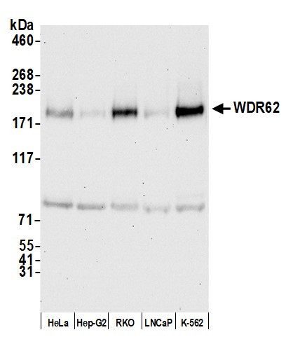 WDR62 Antibody in Western Blot (WB)