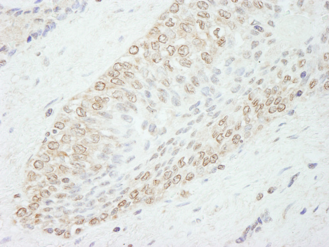 WDR91 Antibody in Immunohistochemistry (Paraffin) (IHC (P))