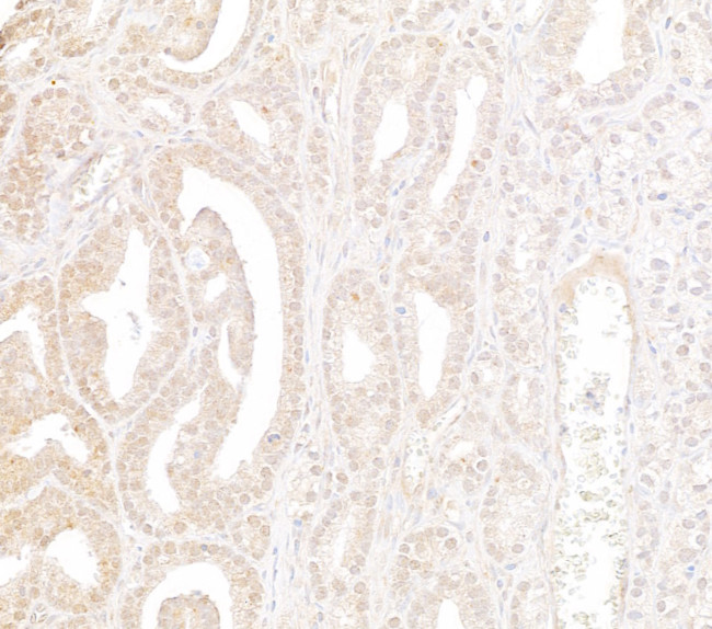 WDR91 Antibody in Immunohistochemistry (Paraffin) (IHC (P))