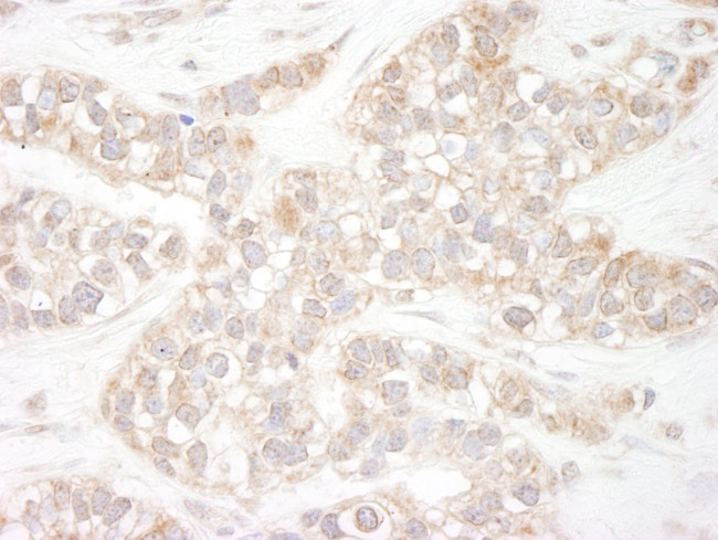 Flightless-1 Antibody in Immunohistochemistry (Paraffin) (IHC (P))