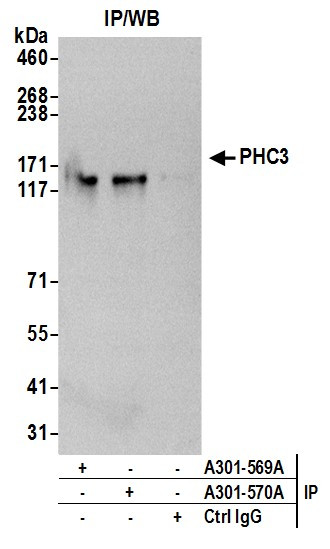 PHC3 Antibody in Immunoprecipitation (IP)