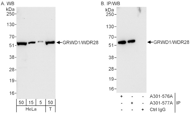 GRWD1/WDR28 Antibody in Western Blot (WB)