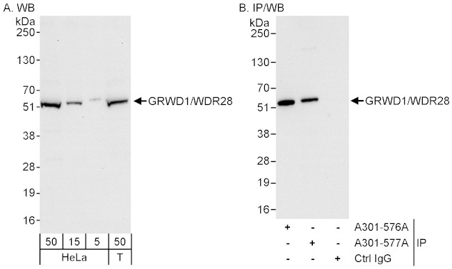 GRWD1/WDR28 Antibody in Western Blot (WB)