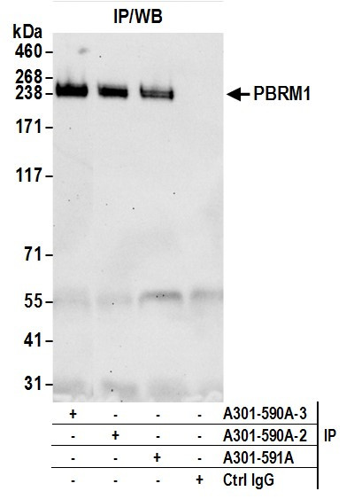 PBRM1 Antibody in Immunoprecipitation (IP)