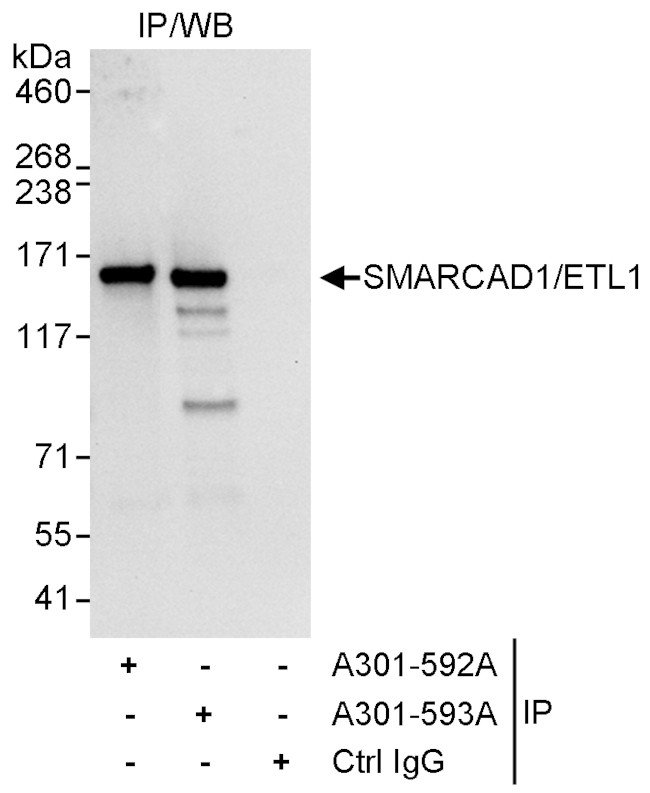 SMARCAD1/ETL1 Antibody in Immunoprecipitation (IP)