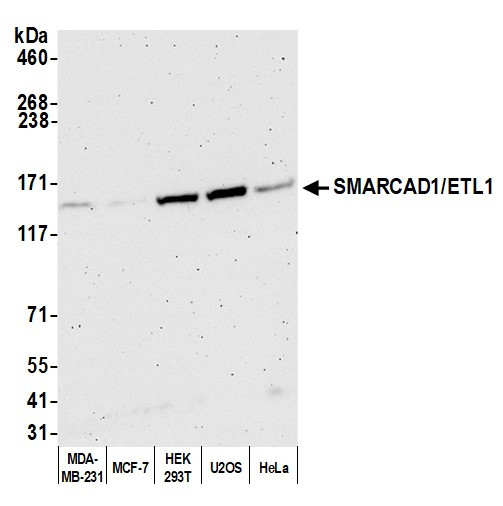 SMARCAD1/ETL1 Antibody in Western Blot (WB)