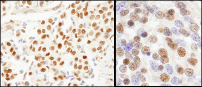 SF3a120/SAP114 Antibody in Immunohistochemistry (Paraffin) (IHC (P))
