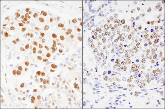 SF3a120/SAP114 Antibody in Immunohistochemistry (Paraffin) (IHC (P))