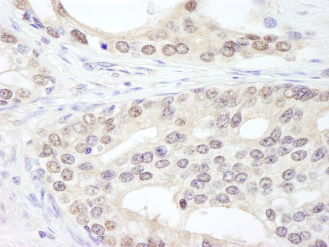 SF3a120/SAP114 Antibody in Immunohistochemistry (Paraffin) (IHC (P))