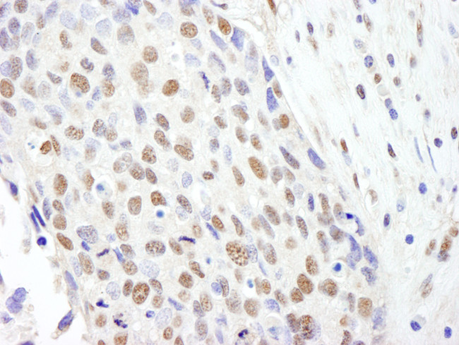 SF3b145/SAP145 Antibody in Immunohistochemistry (Paraffin) (IHC (P))