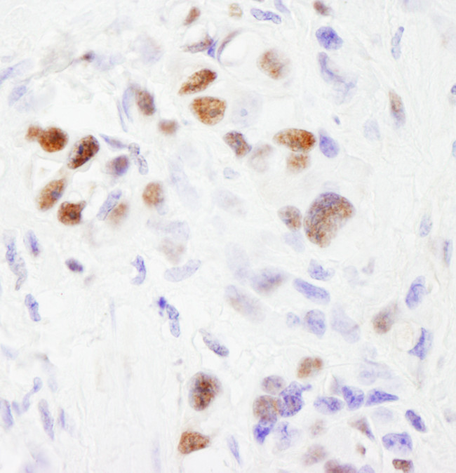 SF3b145/SAP145 Antibody in Immunohistochemistry (Paraffin) (IHC (P))