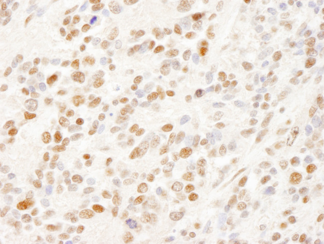 SFRS14 Antibody in Immunohistochemistry (Paraffin) (IHC (P))