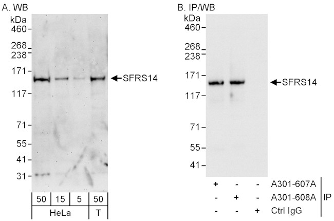 SFRS14 Antibody in Western Blot (WB)