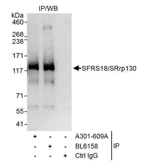 SFRS18/SRrp130 Antibody in Immunoprecipitation (IP)