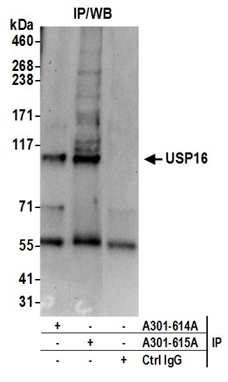 USP16 Antibody in Immunoprecipitation (IP)