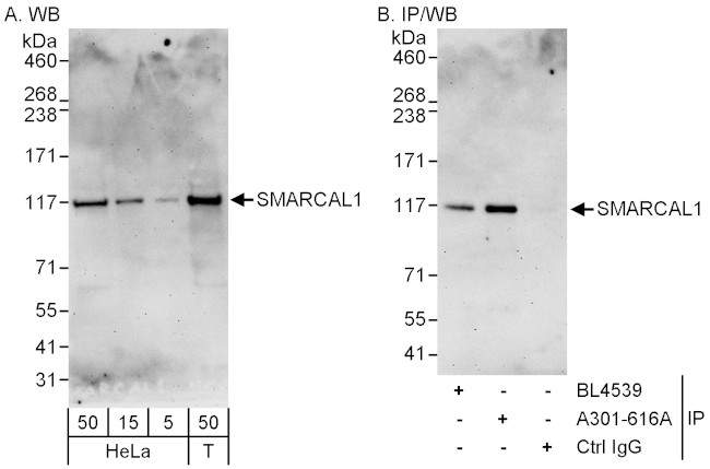 SMARCAL1 Antibody in Western Blot (WB)