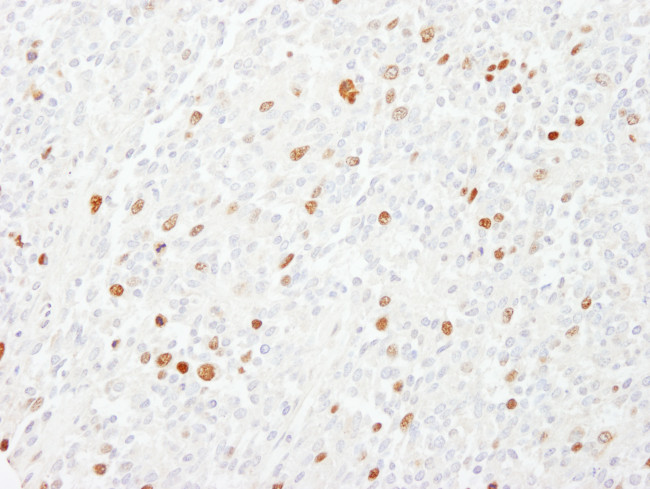 CENP-F/Mitosin Antibody in Immunohistochemistry (Paraffin) (IHC (P))