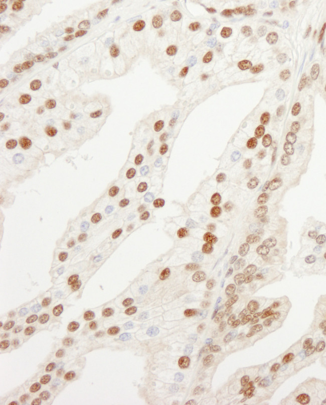 KPNA4 Antibody in Immunohistochemistry (Paraffin) (IHC (P))