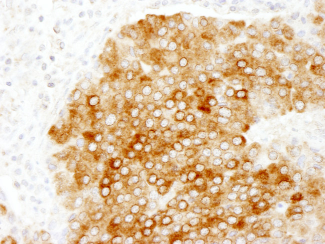 HPIP Antibody in Immunohistochemistry (Paraffin) (IHC (P))