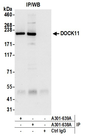 DOCK11 Antibody in Immunoprecipitation (IP)