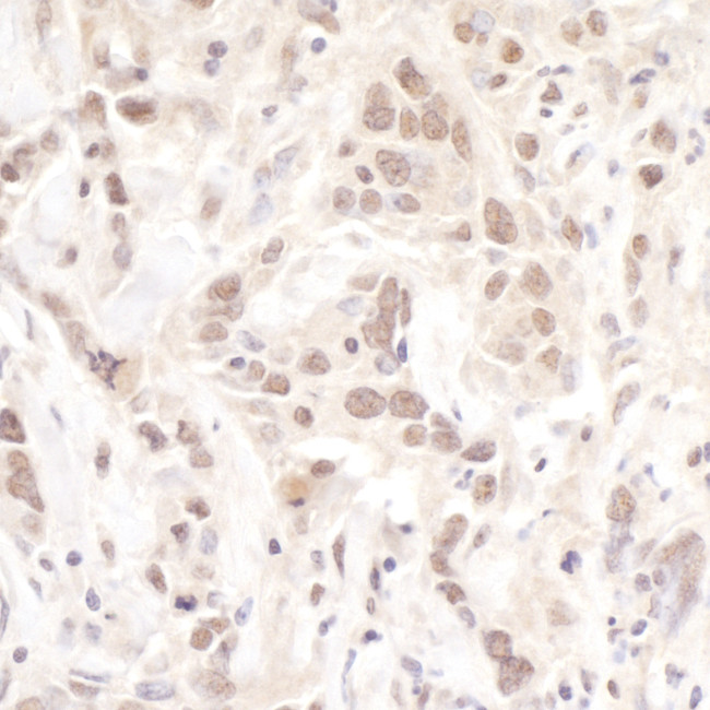 Pol Lambda Antibody in Immunohistochemistry (Paraffin) (IHC (P))
