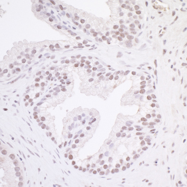MAZ/SAF-1 Antibody in Immunohistochemistry (Paraffin) (IHC (P))