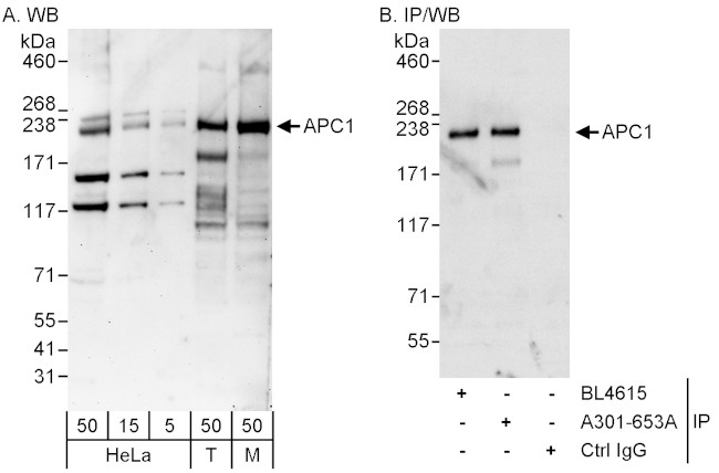 APC1 Antibody in Western Blot (WB)