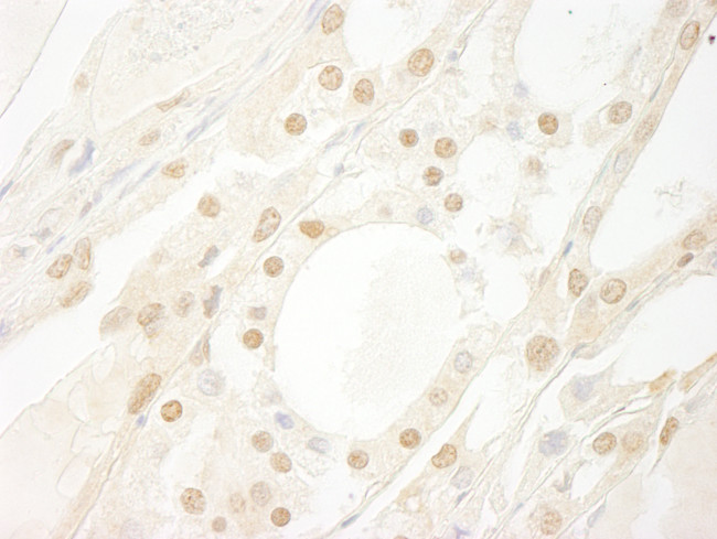 B-Myb Antibody in Immunohistochemistry (Paraffin) (IHC (P))