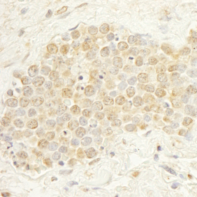 WDR20 Antibody in Immunohistochemistry (Paraffin) (IHC (P))