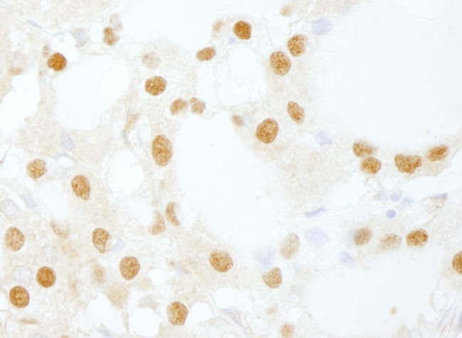 DDX26/DICE1 Antibody in Immunohistochemistry (Paraffin) (IHC (P))