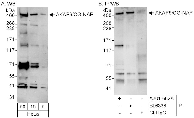 AKAP9/CG-NAP Antibody in Western Blot (WB)