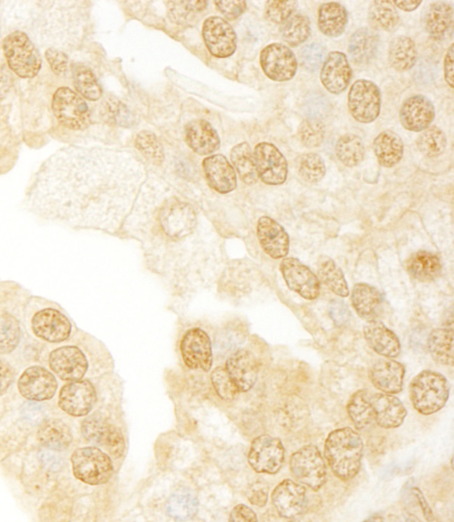 ANKRD17 Antibody in Immunohistochemistry (Paraffin) (IHC (P))