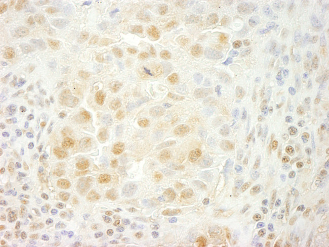 PRPF4B Antibody in Immunohistochemistry (Paraffin) (IHC (P))