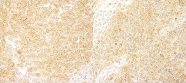 BCAR1/p130CAS Antibody in Immunohistochemistry (Paraffin) (IHC (P))