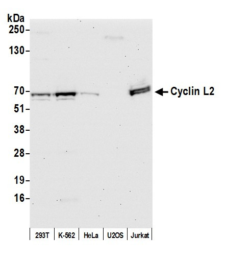Cyclin L2 Antibody in Western Blot (WB)