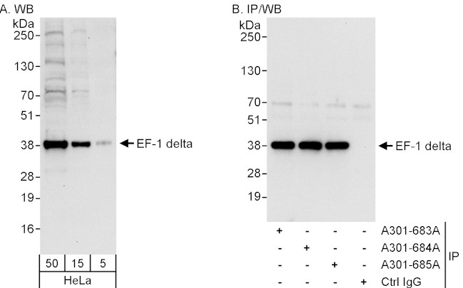 EF-1 delta Antibody in Western Blot (WB)